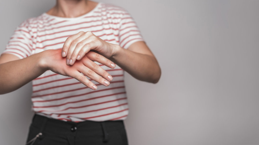 hands with inflammation